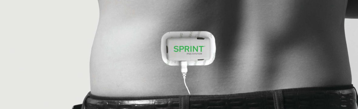 SPRINT-branded-device-on-back-1180x360